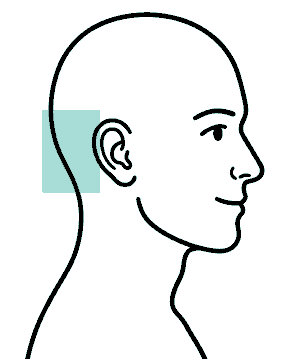 Synthetic side-profile pain map illustration